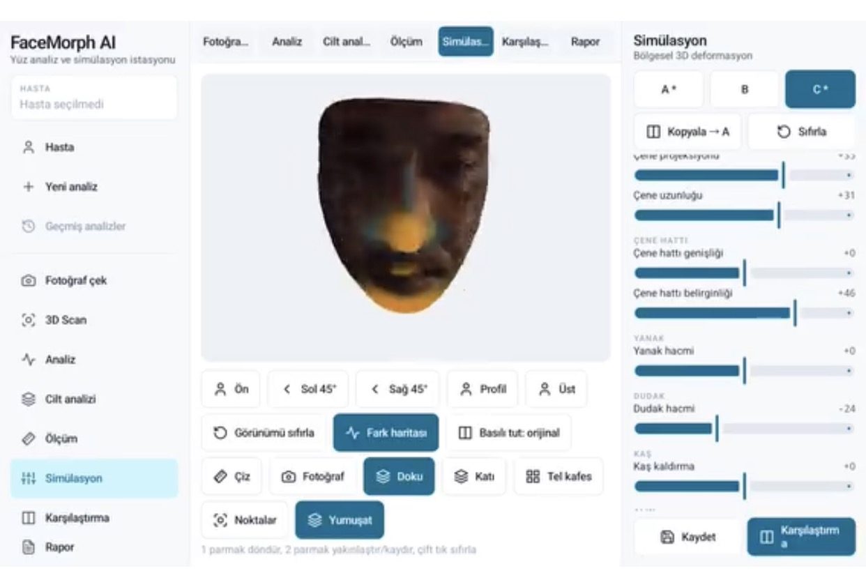 FaceMorph AI — 3D Yüz Analiz ve Estetik Simülasyon ekran görüntüsü – Estetik klinikleri için 3D yüz analizi, ölçüm, dolgu/botoks/lifting simülasyonu, öncesi/sonrası ve PDF rapor